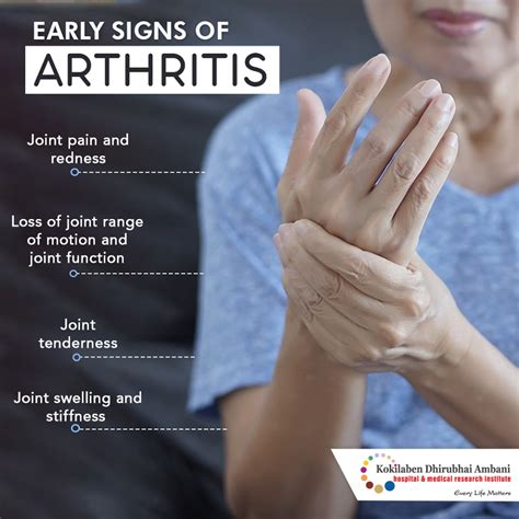 Discover the Early Signs of Arthritis Before It's Too Late!